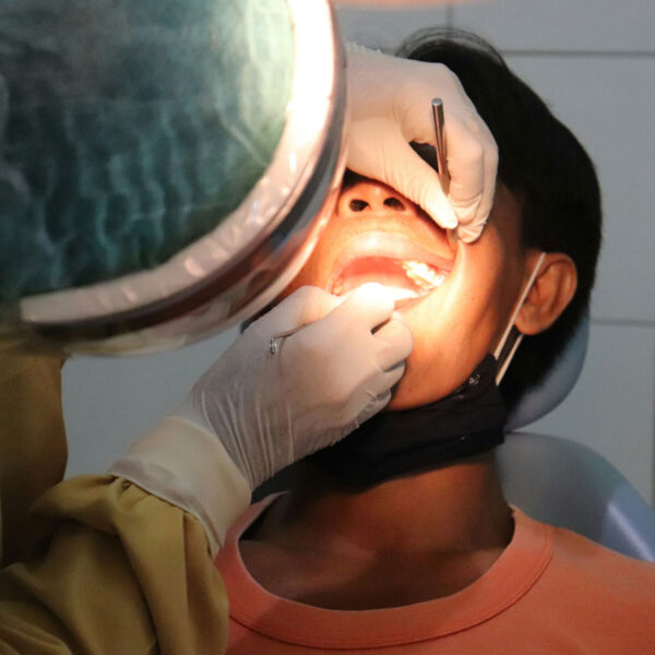 Tartru dentar Tartru dentar