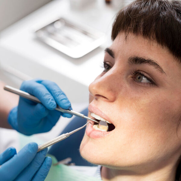 demineralizare-dinti-03 Demineralizare dinti