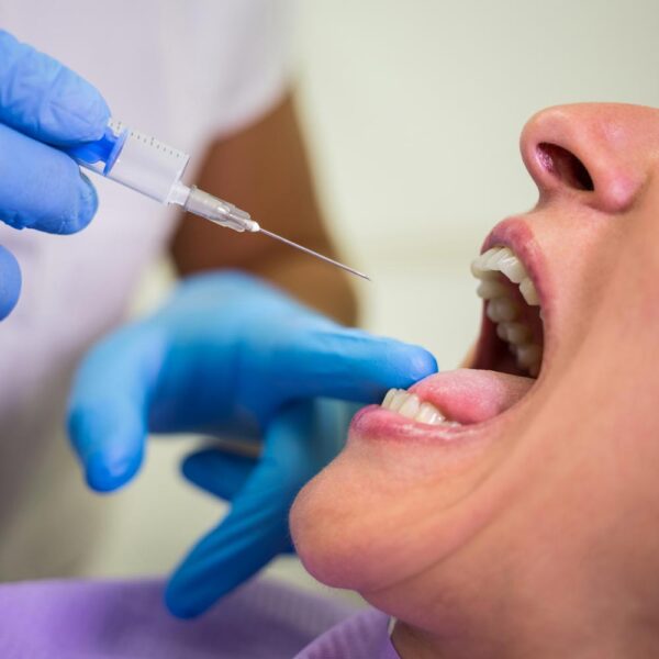 anestezia-dentara-02 Anestezia dentara