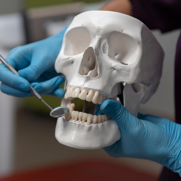 implant-dentar-zigomatic-01 Implant dentar zigomatic