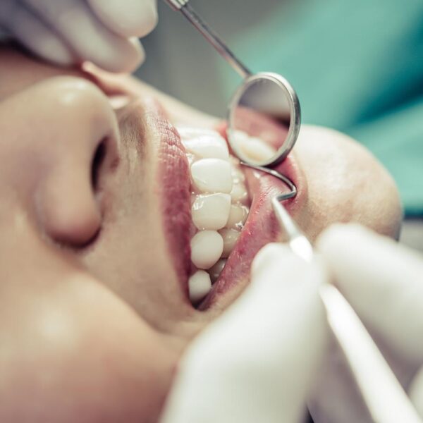 Implant dentar zigomatic