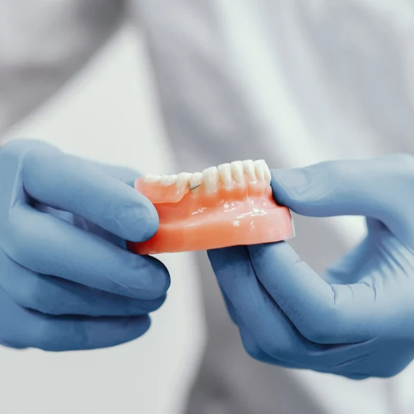 Proteza provizorie dupa extractie - Avantaje